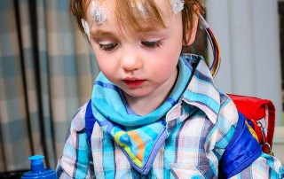 Epilepsia Infantil Tramamento