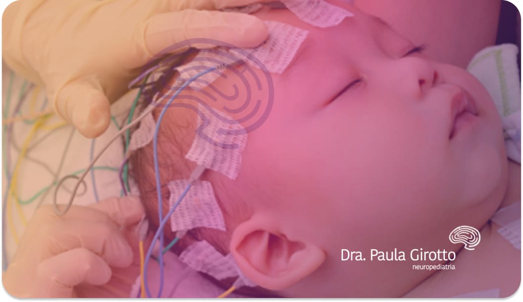 Eletroencefalograma (EEG) – Quando Meu Filho Precisa Fazer?